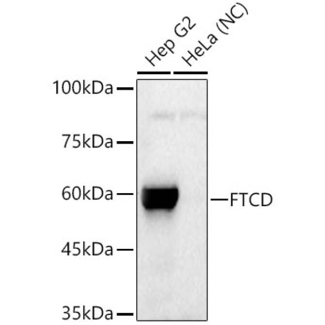 FTCD Rabbit PolyMonoclonal Antibody?
