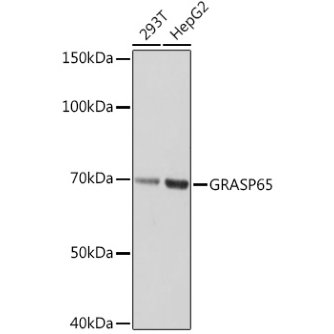 GRASP65 Rabbit Monoclonal Antibody