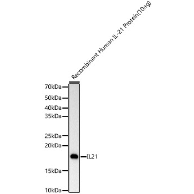 IL21 Rabbit Monoclonal Antibody