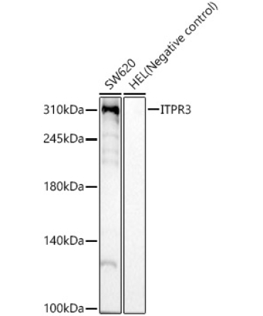 ITPR3 Rabbit Monoclonal Antibody