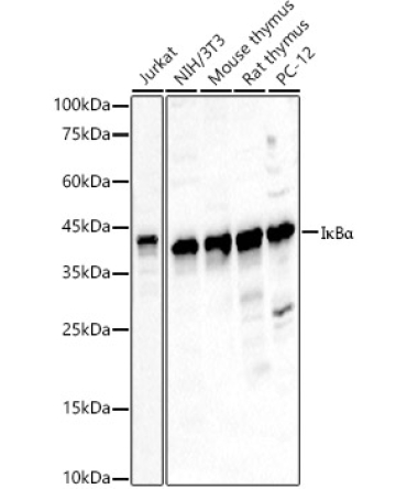 I?BAlpha Rabbit Polyclonal Antibody [KO Validated]