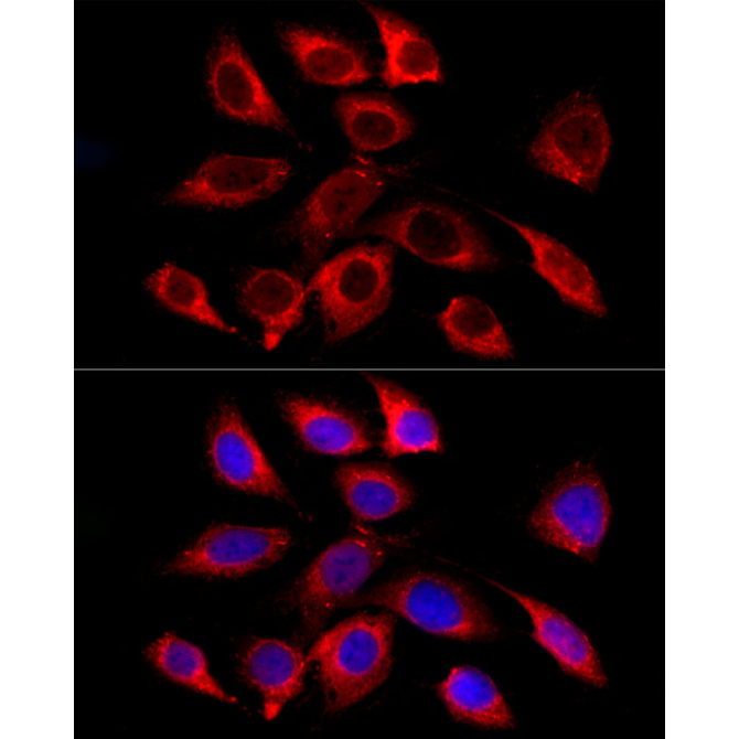 GALC Rabbit Monoclonal Antibody