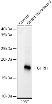 GHRH Rabbit Monoclonal Antibody