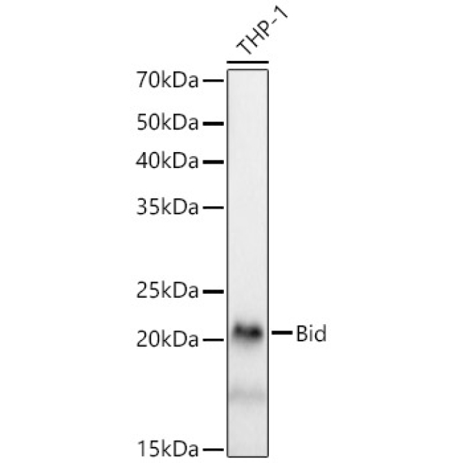 Bid Rabbit Monoclonal Antibody [KD Validated]