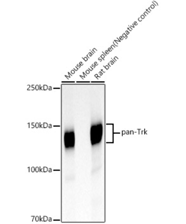 pan-Trk Rabbit Monoclonal Antibody