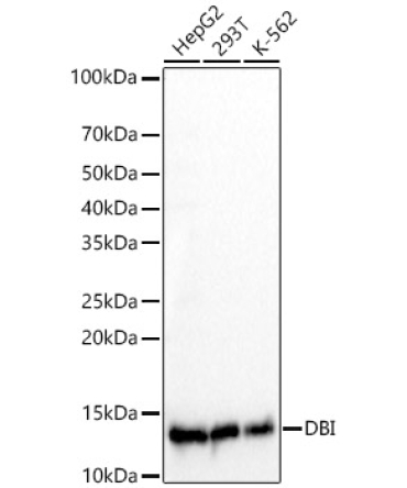 DBI Rabbit Monoclonal Antibody
