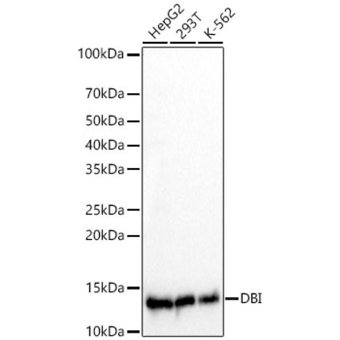 DBI Rabbit Monoclonal Antibody