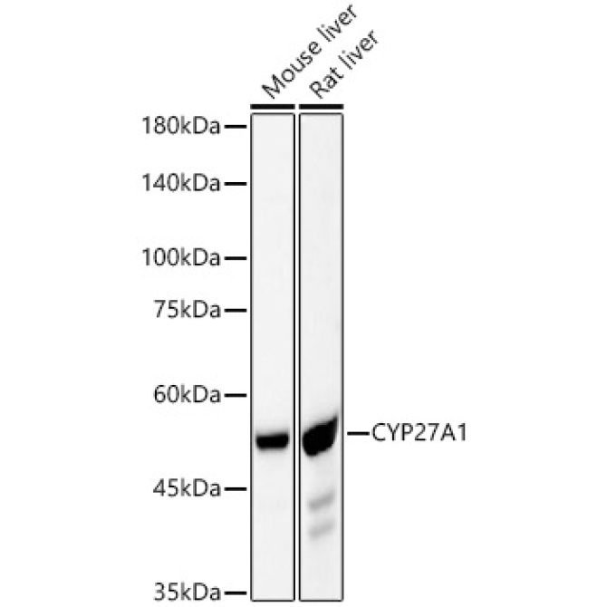 CYP27A1 Rabbit Monoclonal Antibody