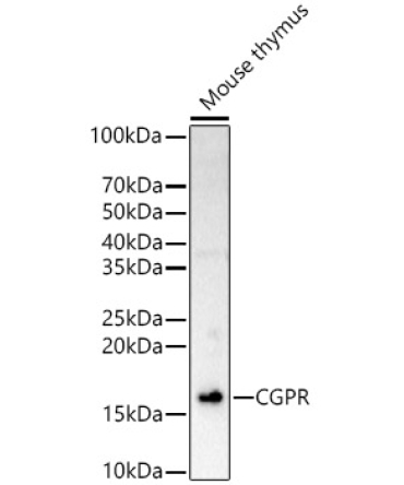 CGPR Rabbit  Polyclonal Antibody