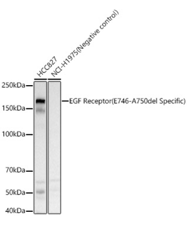 EGF Receptor (E746-A750del Specific) Rabbit  Polyclonal Antibody