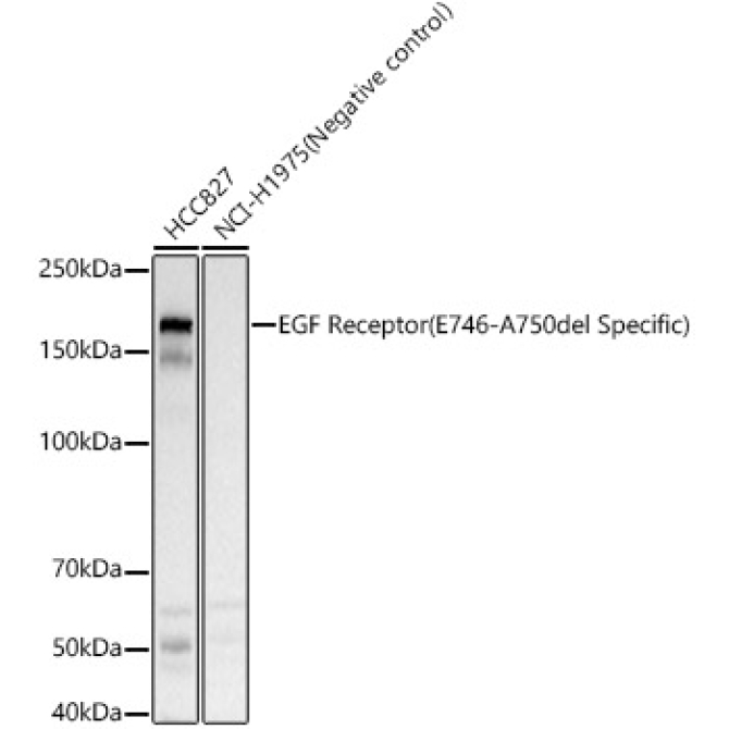 EGF Receptor (E746-A750del Specific) Rabbit  Polyclonal Antibody