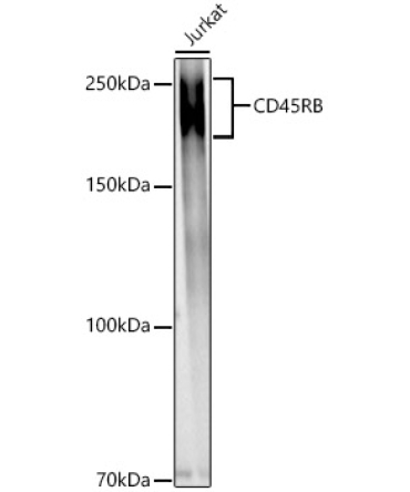 CD45RB Rabbit Polyclonal Antibody