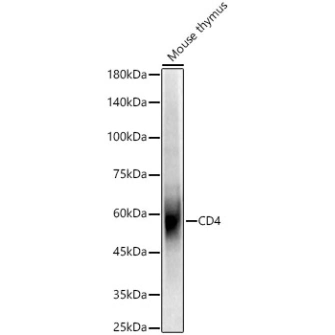 CD4 Rabbit Polyclonal Antibody