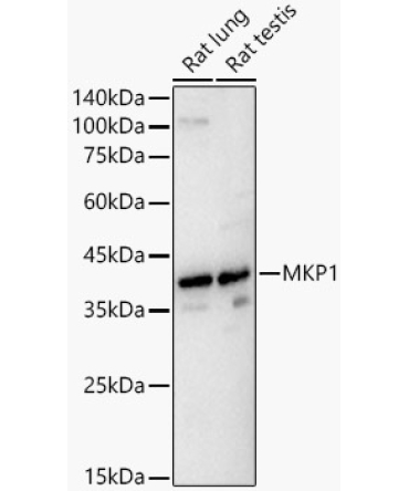 MKP1 Rabbit Polyclonal Antibody
