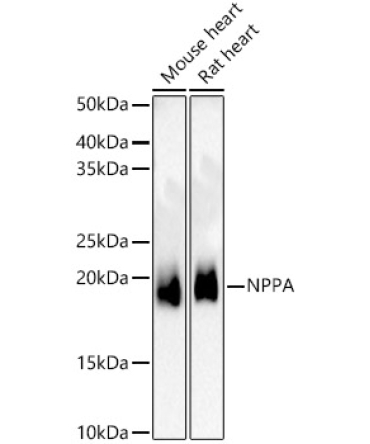 NPPA Rabbit Polyclonal Antibody