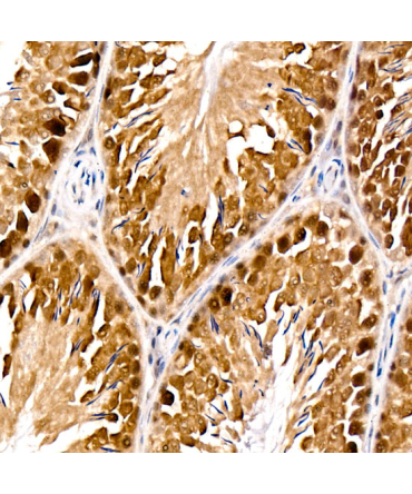 PARG? Rabbit Monoclonal Antibody