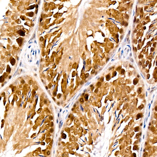 PARG? Rabbit Monoclonal Antibody