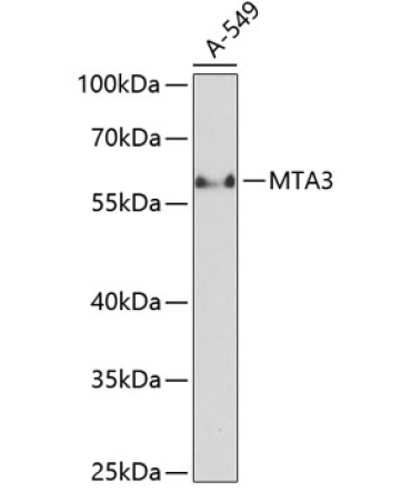 MTA3 Rabbit Polyclonal Antibody