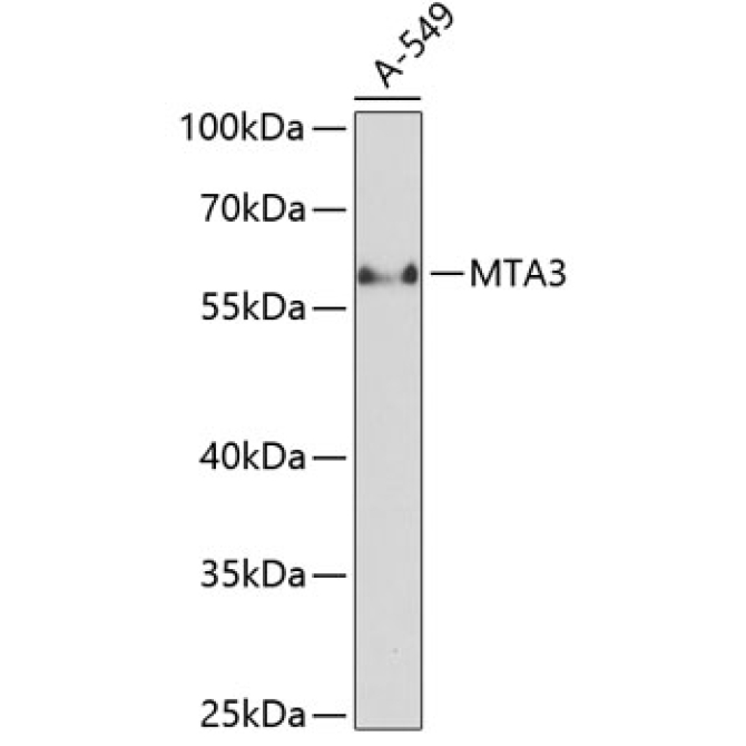 MTA3 Rabbit Polyclonal Antibody