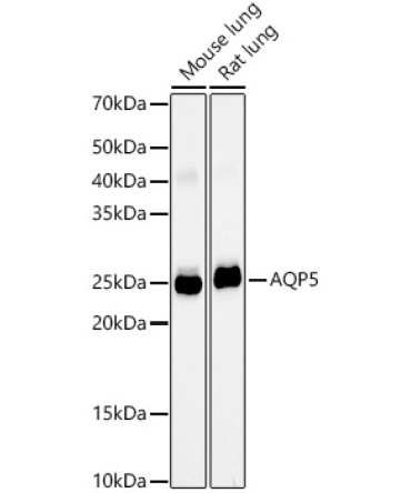 AQP5 Rabbit Monoclonal Antibody