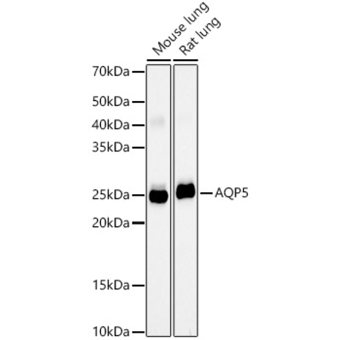 AQP5 Rabbit Monoclonal Antibody