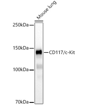 CD117/c-Kit Rabbit Monoclonal Antibody