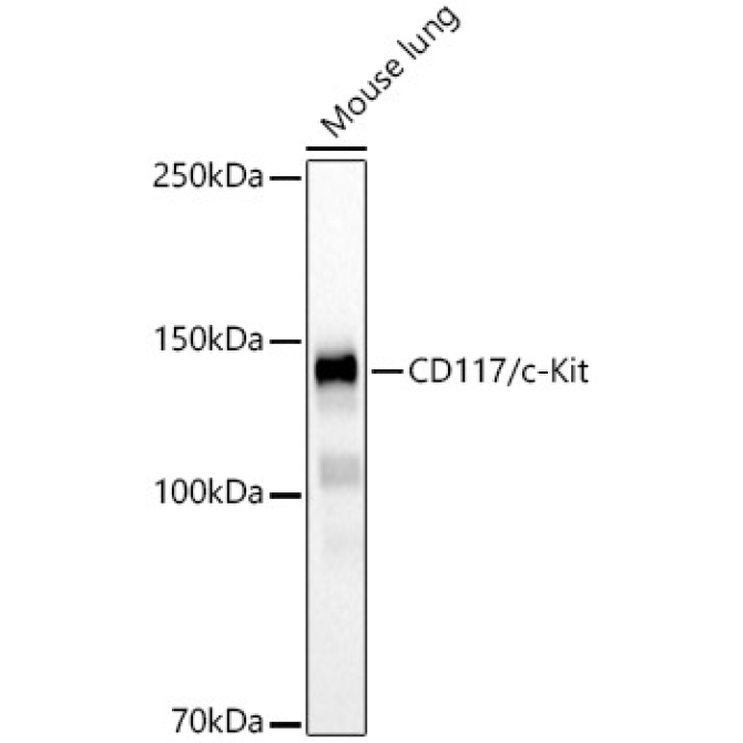 CD117/c-Kit Rabbit Monoclonal Antibody