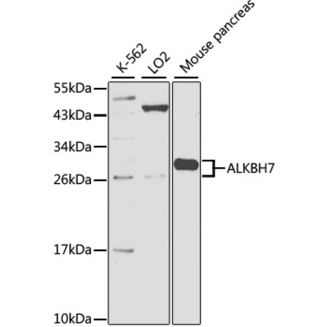 ALKBH7 Rabbit Polyclonal Antibody
