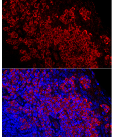 DARC Rabbit Monoclonal Antibody