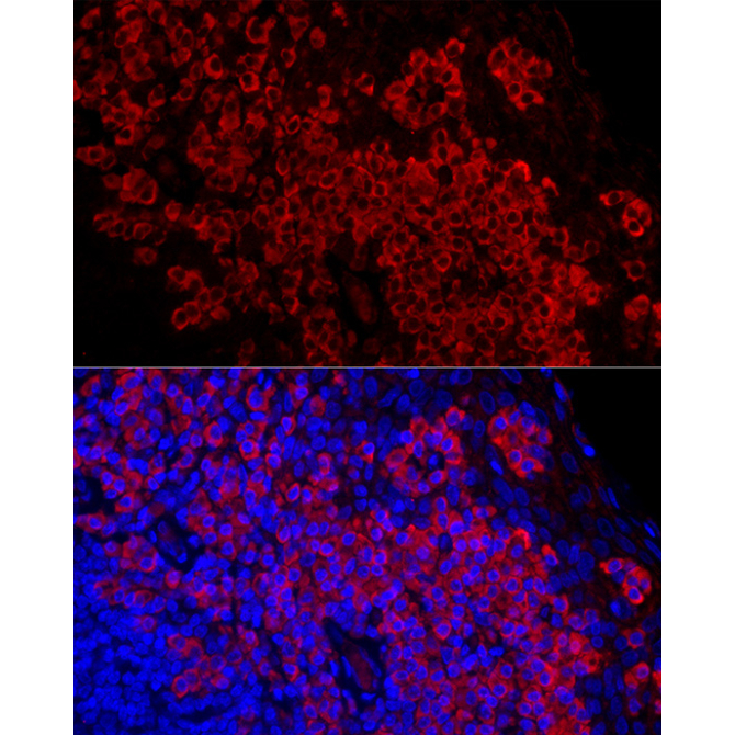 DARC Rabbit Monoclonal Antibody