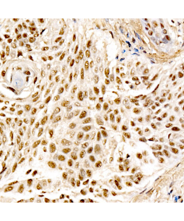 MDM2 Rabbit Monoclonal Antibody