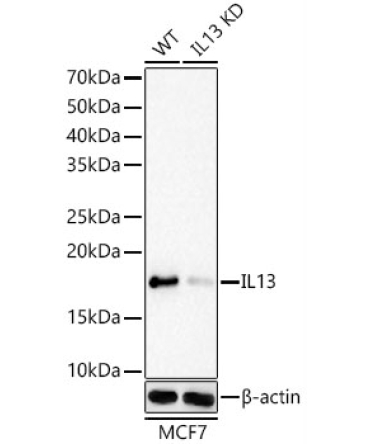 IL13 Rabbit Monoclonal Antibody [KD Validated]