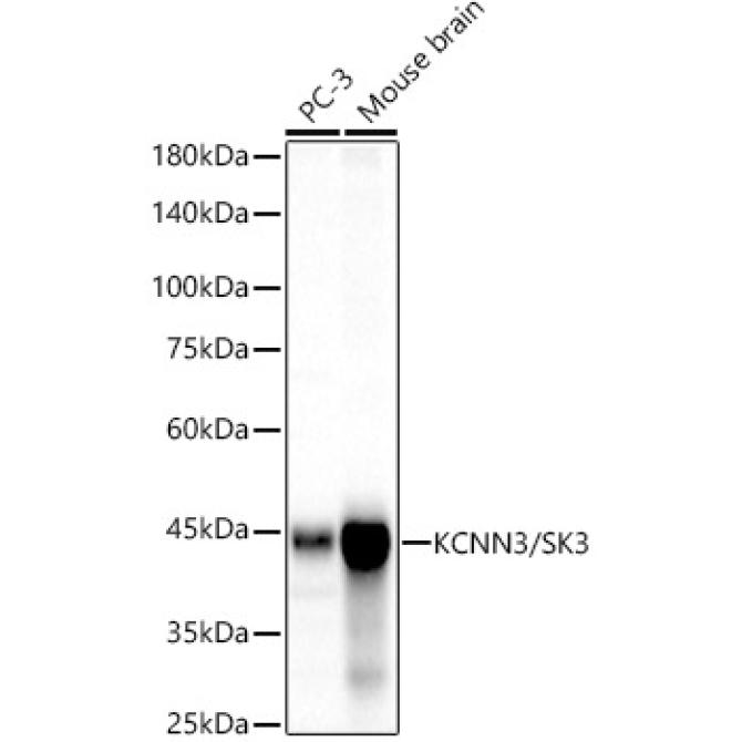 KCNN3/SK3 Rabbit Monoclonal Antibody
