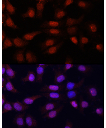 N5-Methylcytidine Rabbit Polyclonal Antibody
