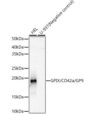 GPIX/CD42a/GP9 Rabbit Monoclonal Antibody