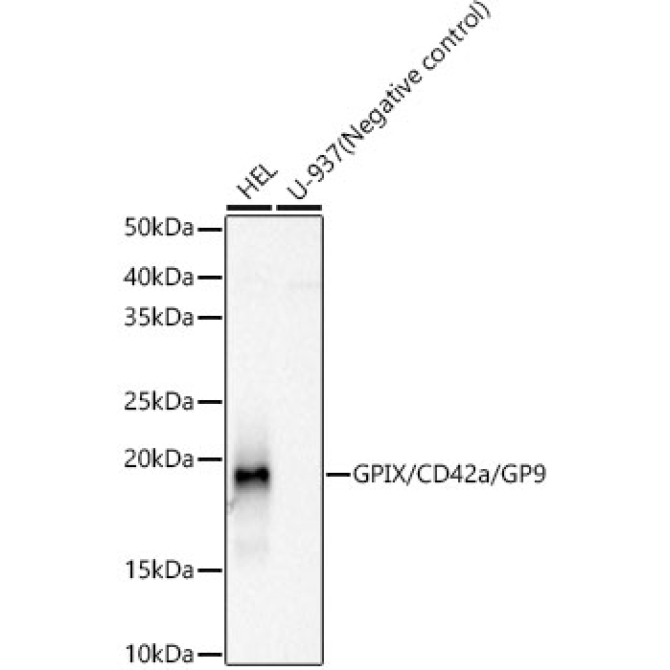 GPIX/CD42a/GP9 Rabbit Monoclonal Antibody