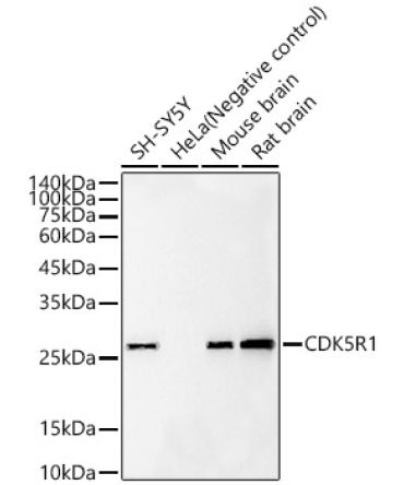 CDK5R1 Rabbit Monoclonal Antibody