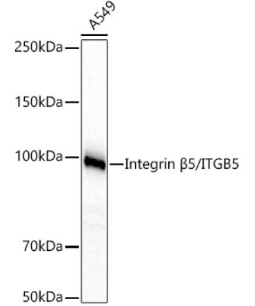Integrin Beta5/ITGB5 Rabbit Monoclonal Antibody
