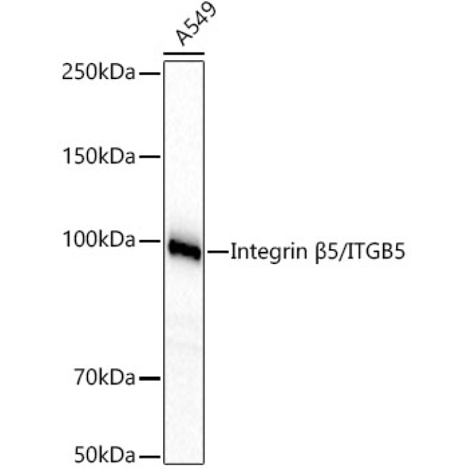 Integrin Beta5/ITGB5 Rabbit Monoclonal Antibody