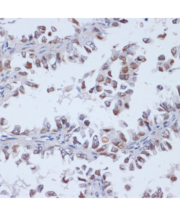 DNMT3L Rabbit Polyclonal Antibody
