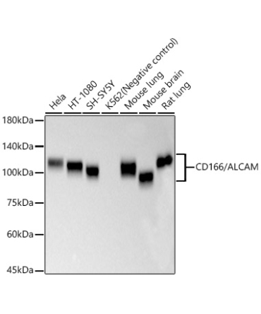 CD166/ALCAM Rabbit Monoclonal Antibody