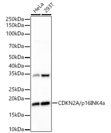 CDKN2A/p16INK4a Rabbit Monoclonal Antibody