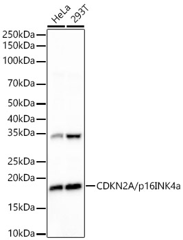 CDKN2A/p16INK4a Rabbit Monoclonal Antibody