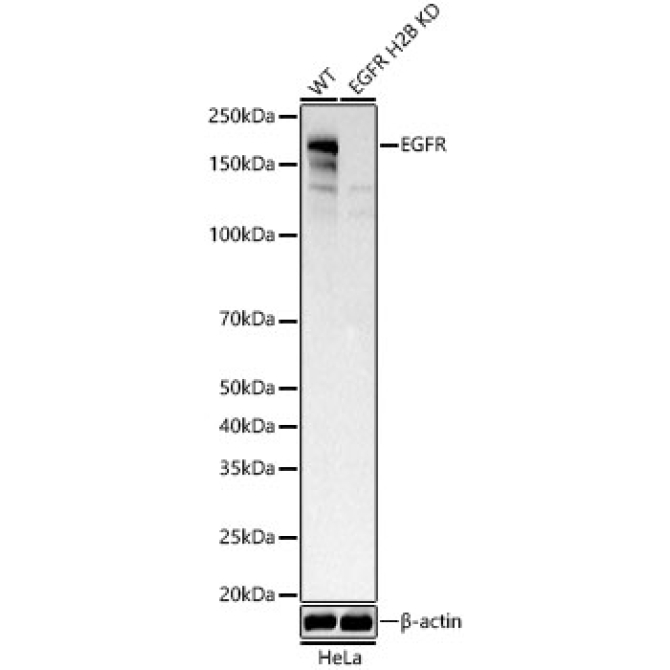 EGFR Rabbit Monoclonal Antibody [KD Validated]