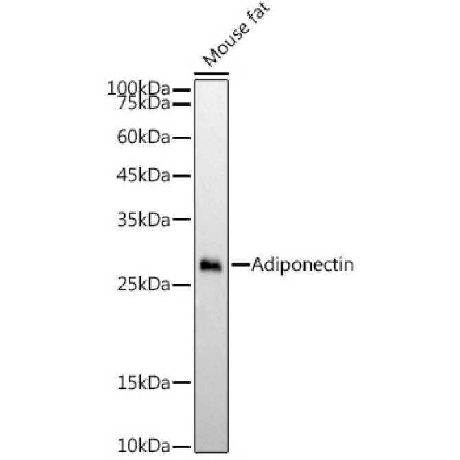 Adiponectin Rabbit Monoclonal Antibody