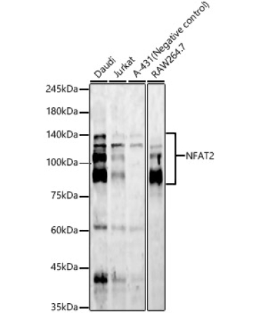 NFAT2 Rabbit Monoclonal Antibody