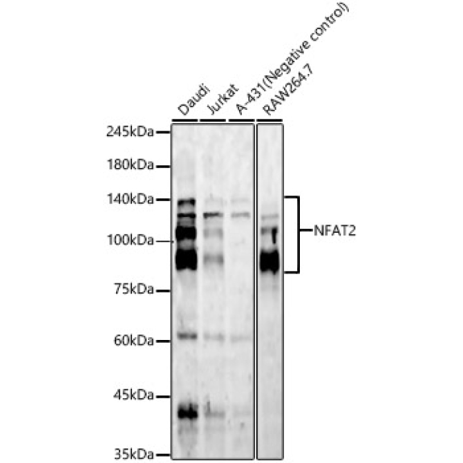 NFAT2 Rabbit Monoclonal Antibody