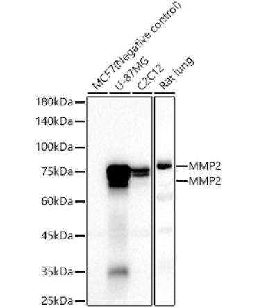 MMP2 Rabbit Monoclonal Antibody