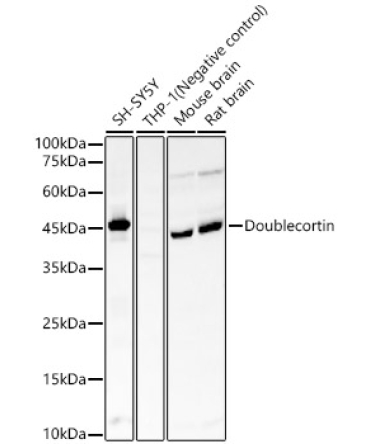 Doublecortin Rabbit Monoclonal Antibody