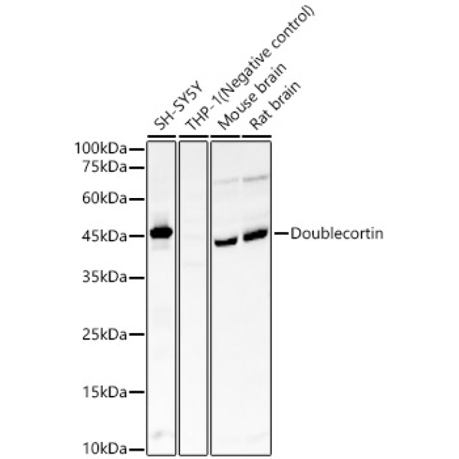 Doublecortin Rabbit Monoclonal Antibody